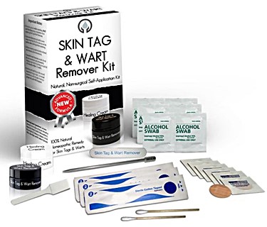 Skin Tag & Wart Remover Kit Review