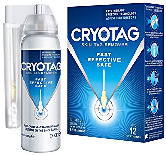 Cryotag Skin Tag Remover Review
